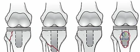 Clinical Image