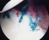 Clinical Image