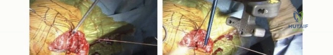 Clinical Image
