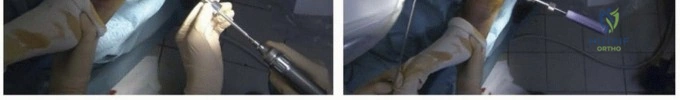 Clinical Image
