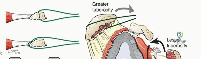 Clinical Image