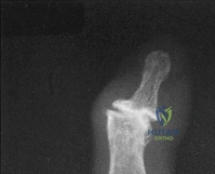 Clinical Image