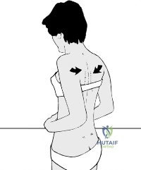 Clinical Image
