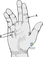 Clinical Image