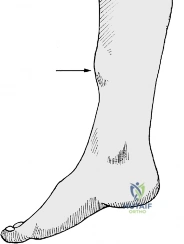 Clinical Image