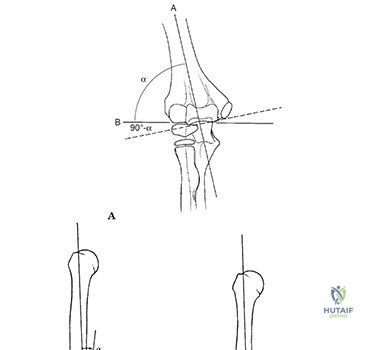 Clinical Image