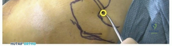 Clinical Image