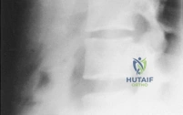 Clinical Image