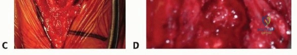 Clinical Image