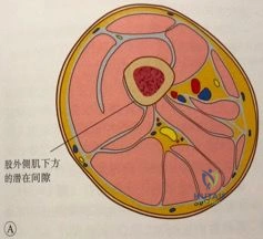 Clinical Image
