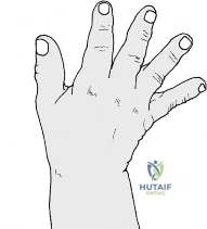 Clinical Image