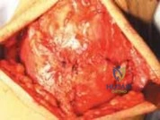 Clinical Image