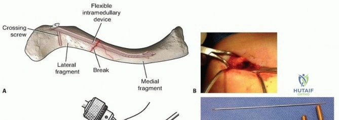 Clinical Image