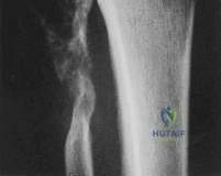 Clinical Image