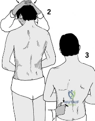 Clinical Image