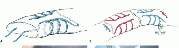 Clinical Image