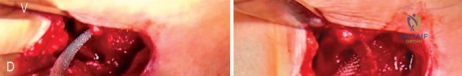 Clinical Image