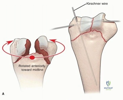 Clinical Image