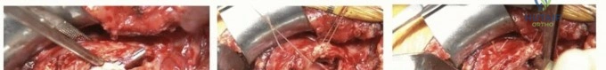 Clinical Image