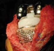 Clinical Image