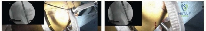 Clinical Image