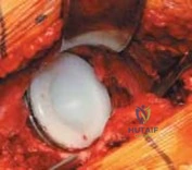 Clinical Image