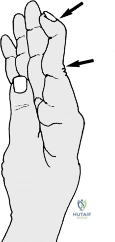 Clinical Image