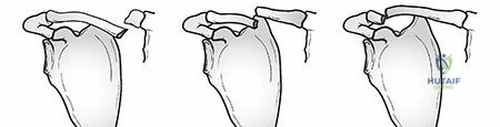 Clinical Image