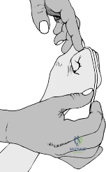 Clinical Image