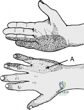 Clinical Image