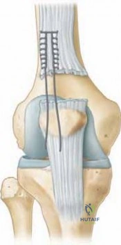 Clinical Image