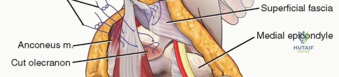 Clinical Image