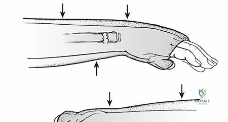 Clinical Image