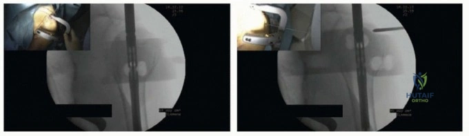Clinical Image