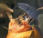 Clinical Image
