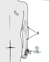 Clinical Image
