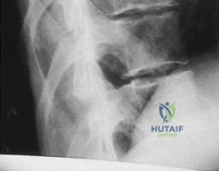 Clinical Image