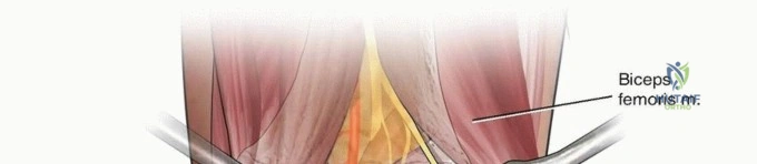 Clinical Image