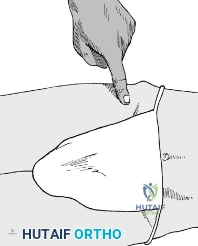 Clinical Image