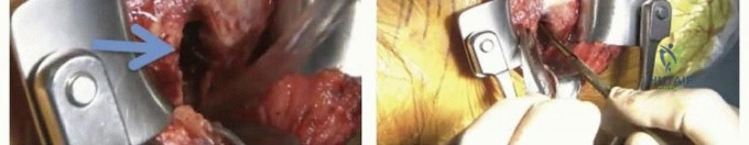 Clinical Image