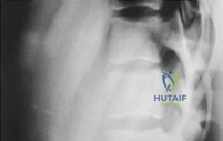 Clinical Image