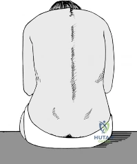 Clinical Image