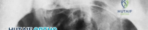 Clinical Image