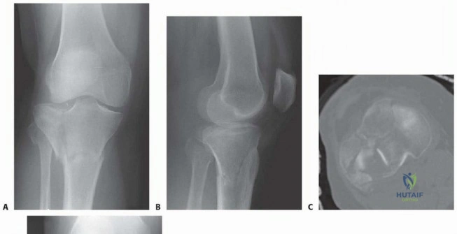 Clinical Image