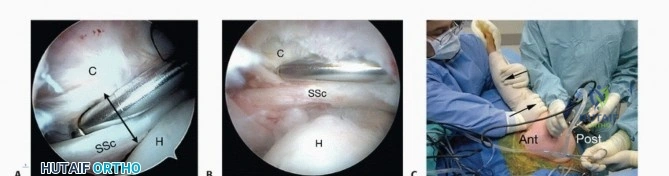 Clinical Image