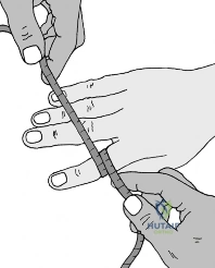 Clinical Image