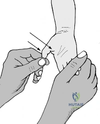 Clinical Image