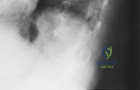 Clinical Image