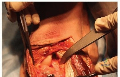 Clinical Image