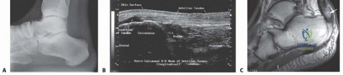 Clinical Image